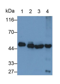 Invitrogen NSE Polyclonal Antibody 200 &mu;L; Unconjugated:Antibodies,