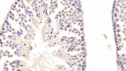 Invitrogen DSPG3 Polyclonal Antibody:Antibodies:Primary Antibodies
