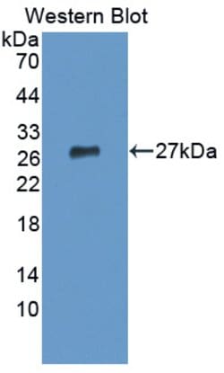 Invitrogen DSPG3 Polyclonal Antibody:Antibodies:Primary Antibodies
