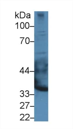 Invitrogen DSPG3 Polyclonal Antibody 20 &mu;L; Unconjugated:Antibodies,