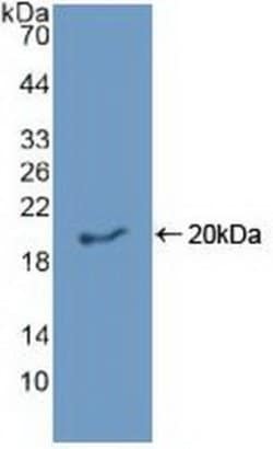 Invitrogen Epiregulin Polyclonal Antibody 20 &mu;L; Unconjugated:Antibodies,