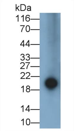 Invitrogen Epiregulin Polyclonal Antibody:Antibodies:Primary Antibodies