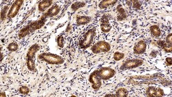 Invitrogen EpCAM (CD326) Polyclonal Antibody 200 &mu;L; Unconjugated:Antibodies,