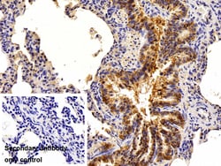Invitrogen EpCAM (CD326) Polyclonal Antibody 200 &mu;L; Unconjugated:Antibodies,