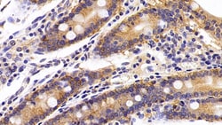Invitrogen EpCAM (CD326) Polyclonal Antibody 200 &mu;L; Unconjugated:Antibodies,