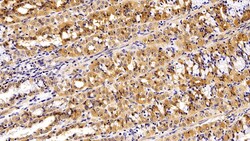 Invitrogen EpCAM (CD326) Polyclonal Antibody 200 &mu;L; Unconjugated:Antibodies,