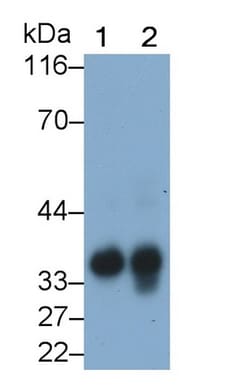 Invitrogen EpCAM (CD326) Polyclonal Antibody 200 &mu;L; Unconjugated:Antibodies,