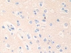 Invitrogen Epsin 1 Polyclonal Antibody:Antibodies:Primary Antibodies