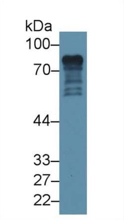 Invitrogen Epsin 1 Polyclonal Antibody:Antibodies:Primary Antibodies