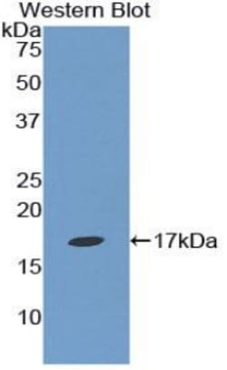 Invitrogen Epsin 1 Polyclonal Antibody:Antibodies:Primary Antibodies