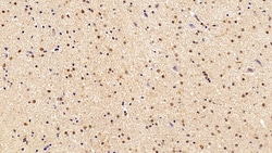 Invitrogen CRM1 Polyclonal Antibody:Antibodies:Primary Antibodies