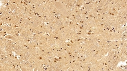 Invitrogen CRM1 Polyclonal Antibody:Antibodies:Primary Antibodies