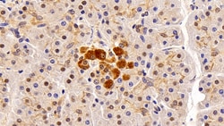 Invitrogen CRM1 Polyclonal Antibody:Antibodies:Primary Antibodies