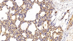 Invitrogen CRM1 Polyclonal Antibody:Antibodies:Primary Antibodies