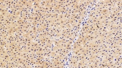 Invitrogen CRM1 Polyclonal Antibody:Antibodies:Primary Antibodies