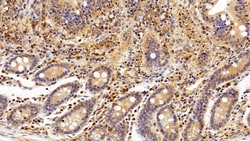 Invitrogen CRM1 Polyclonal Antibody:Antibodies:Primary Antibodies