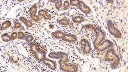 Invitrogen CRM1 Polyclonal Antibody:Antibodies:Primary Antibodies