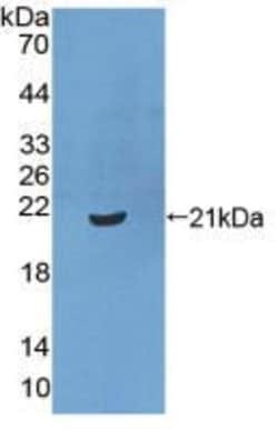 Invitrogen CRM1 Polyclonal Antibody:Antibodies:Primary Antibodies
