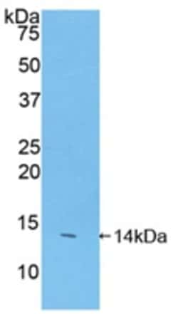 Invitrogen FAM19A2 Polyclonal Antibody 200 &mu;L; Unconjugated:Antibodies,