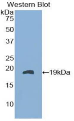 Invitrogen FABP9 Polyclonal Antibody:Antibodies:Primary Antibodies