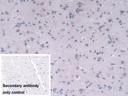 Invitrogen FADS2 Polyclonal Antibody:Antibodies:Primary Antibodies