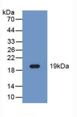 Invitrogen FADS2 Polyclonal Antibody:Antibodies:Primary Antibodies