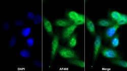 Invitrogen Ferritin Heavy Chain Polyclonal Antibody 200 &mu;L; Unconjugated:Antibodies,
