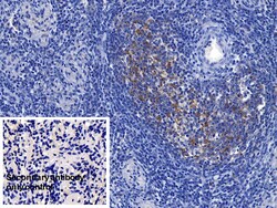 Invitrogen Ferritin Heavy Chain Polyclonal Antibody 200 &mu;L; Unconjugated:Antibodies,