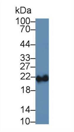 Invitrogen Ferritin Heavy Chain Polyclonal Antibody 200 &mu;L; Unconjugated:Antibodies,