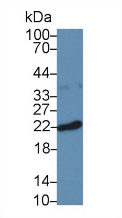 Invitrogen Ferritin Heavy Chain Polyclonal Antibody 200 &mu;L; Unconjugated:Antibodies,