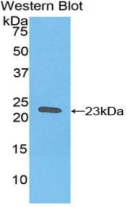 Invitrogen Ferritin Heavy Chain Polyclonal Antibody 200 &mu;L; Unconjugated:Antibodies,