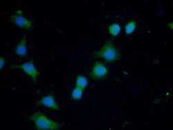 Invitrogen Ferritin Heavy Chain Polyclonal Antibody:Antibodies:Primary