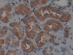 Invitrogen Ferritin Heavy Chain Polyclonal Antibody:Antibodies:Primary