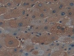 Invitrogen Ferritin Heavy Chain Polyclonal Antibody:Antibodies:Primary