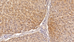 Invitrogen Ferritin Heavy Chain Polyclonal Antibody:Antibodies:Primary