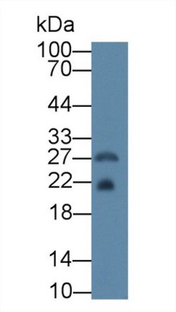 Invitrogen Ferritin Heavy Chain Polyclonal Antibody:Antibodies:Primary