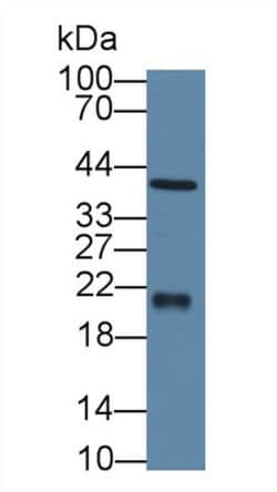 Invitrogen Ferritin Heavy Chain Polyclonal Antibody:Antibodies:Primary