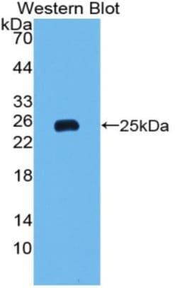 Invitrogen Ferritin Heavy Chain Polyclonal Antibody:Antibodies:Primary