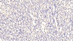 Invitrogen Ferritin Heavy Chain Polyclonal Antibody:Antibodies:Primary