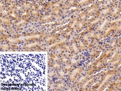 Invitrogen Ferritin Heavy Chain Polyclonal Antibody:Antibodies:Primary