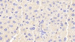 Invitrogen Ferritin Heavy Chain Polyclonal Antibody:Antibodies:Primary
