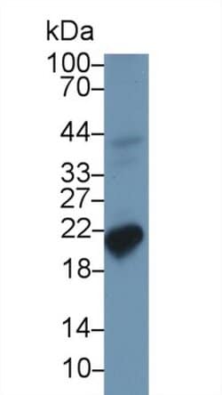 Invitrogen Ferritin Heavy Chain Polyclonal Antibody:Antibodies:Primary