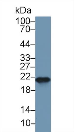 Invitrogen Ferritin Heavy Chain Polyclonal Antibody:Antibodies:Primary