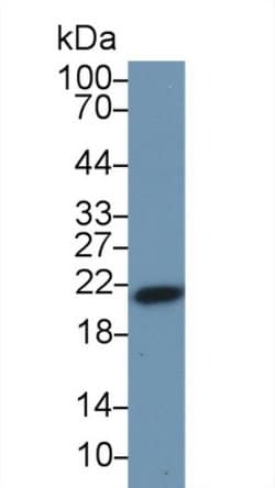 Invitrogen Ferritin Heavy Chain Polyclonal Antibody:Antibodies:Primary