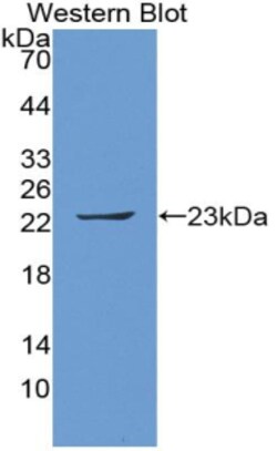 Invitrogen Ferritin Heavy Chain Polyclonal Antibody:Antibodies:Primary