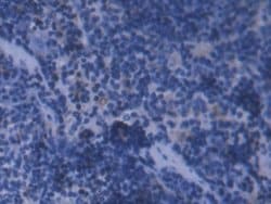 Invitrogen Ferritin Light Chain Polyclonal Antibody 200 &mu;L; Unconjugated:Antibodies,