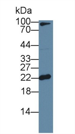 Invitrogen Ferritin Light Chain Polyclonal Antibody 20 μL; Unconjugated:Antibodies,