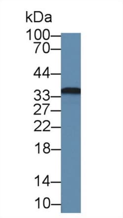 Invitrogen Fibrillarin Polyclonal Antibody:Antibodies:Primary Antibodies