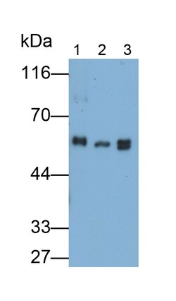 Invitrogen Fibrinogen Beta Chain Polyclonal Antibody 20 &mu;L | Buy Online | Invitrogen&trade; | Fisher Scientific