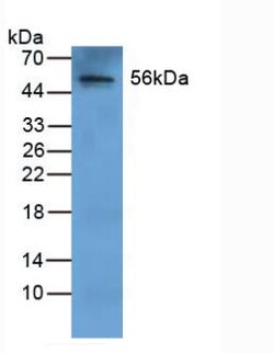Invitrogen Fibrinogen Beta Chain Polyclonal Antibody 20 &mu;L | Buy Online | Invitrogen&trade; | Fisher Scientific